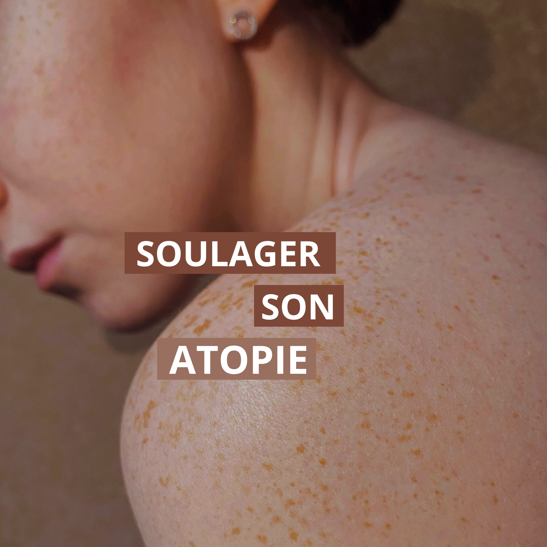 soulager sa peau atopique